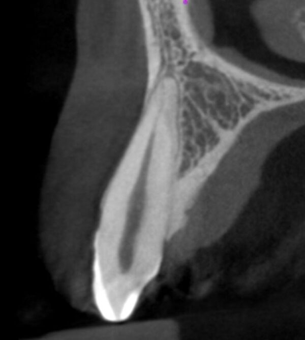 Interpretation of CBCT What a dental practitioner should know? CBCT